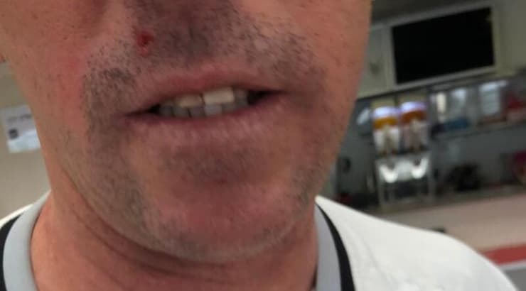 מאמן הטניס פצוע (פרטי) מאמן הטניס פצוע