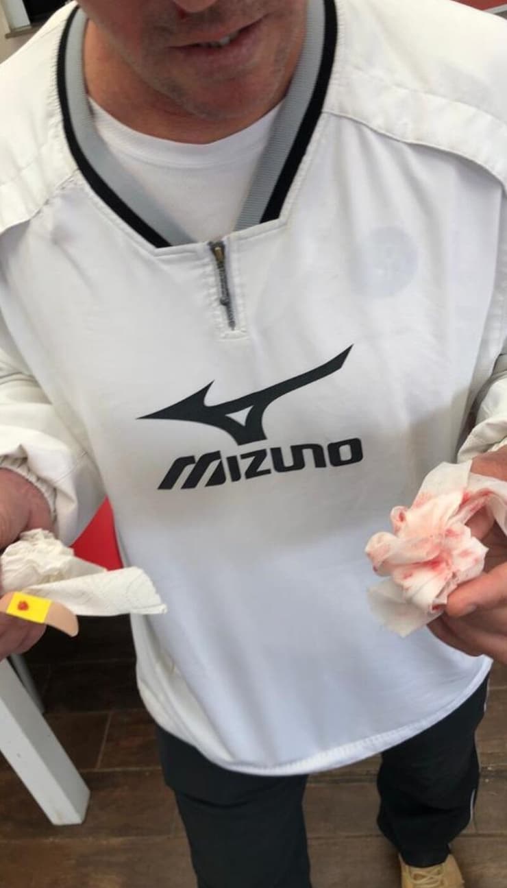 מאמן הטניס פצוע (פרטי) מאמן הטניס פצוע