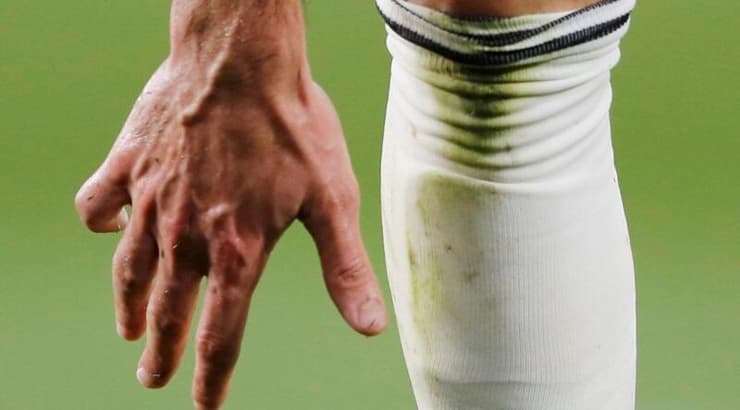 הזרת הפגועה של בנזמה ב-2019 (רויטרס) הזרת הפגועה של בנזמה ב-2019