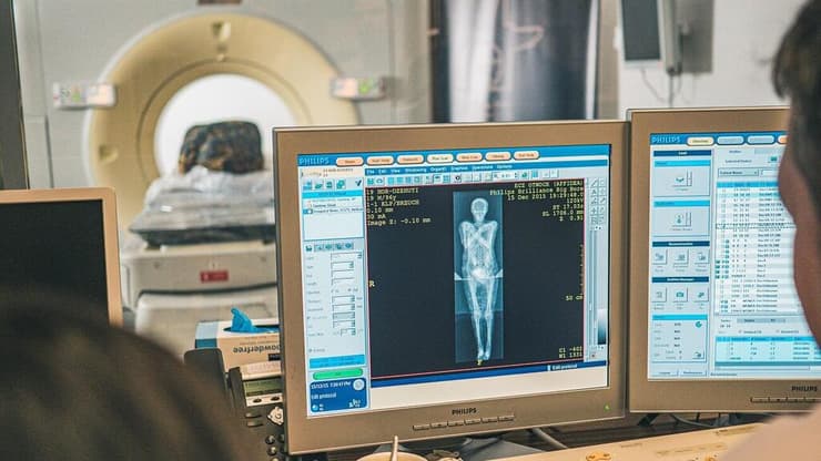 חוקרים בוחנים את סריקת ה-CT של 'הגברת המסתורית'