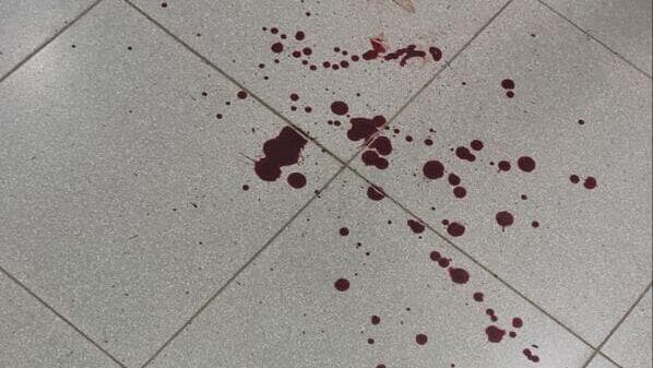 דם הפצוע על הרצפה