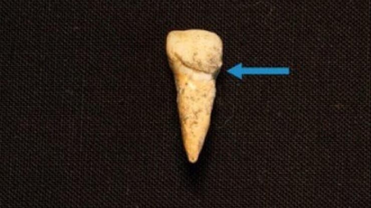 דוגמה של אחת השיניים שנבדקה על ידי החוקרים