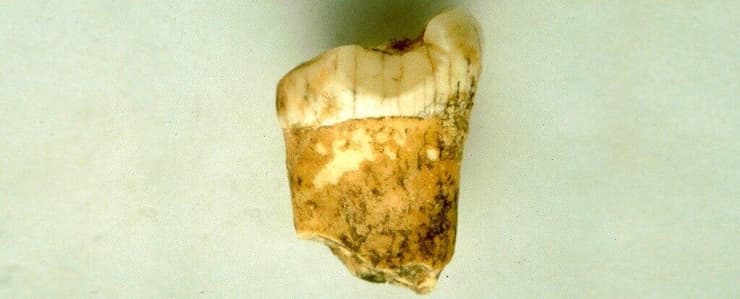 השן הקדומה