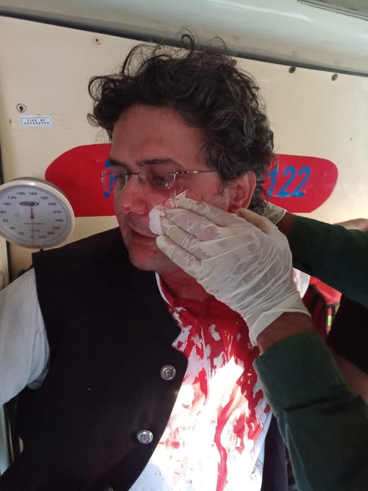 פוליטיקאי ב פקיסטן בשם פייסל ג'אווד שנפצע במהלך ירי על שיירת ראש הממשלה לשעבר אימראן חאן ב ווזיראבאד