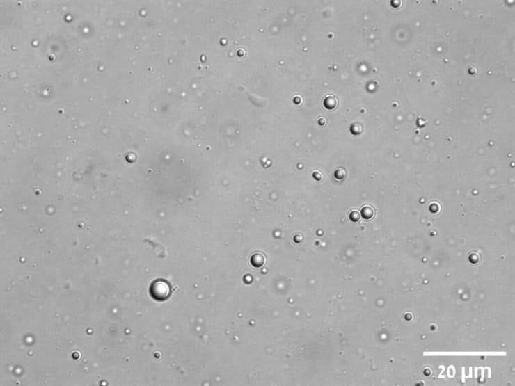 כמו טיפות שומן במרק עוף: תמונת מיקרוסקופ של הטיפות הזעירות שנוצרו בתמיסה בעקבות חיבור בין פפטידים למולקולות אר-אן-אי