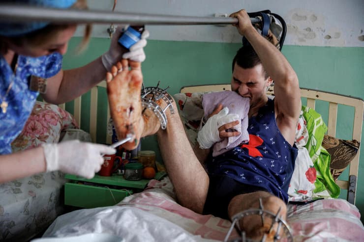 תמונות השנה 2022 אולג סמולין מתמודד עם הכאב בעודו מקבל טיפול מאחות בבית חולים ליד חרקוב אחרי שנפצע במתקפת רקטות רוסית