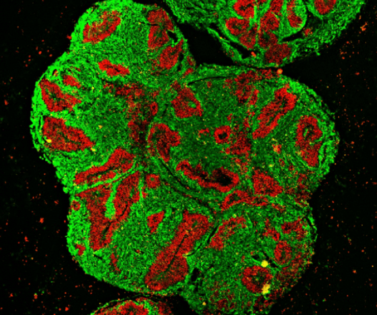 אורגנואיד מוחי של קרנף, בתמונת חתך מיקרוסקופית