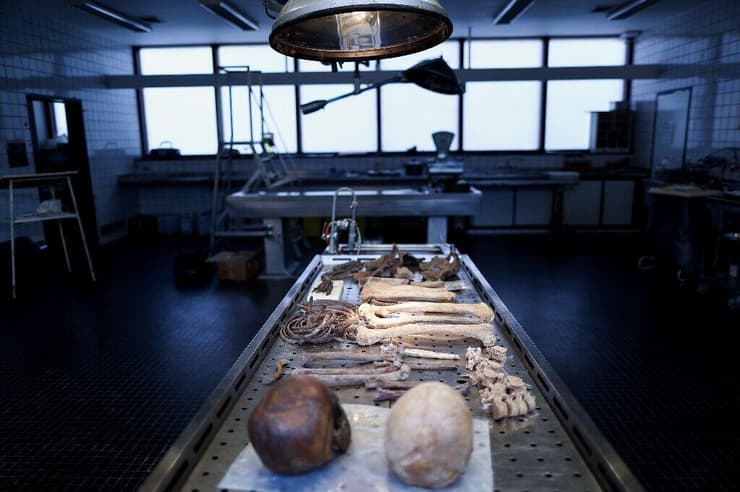 חלק משרידי העצמות של לוחמי קרב ווטרלו, אשר התגלו בחלקם בחפירות ארכיאולוגיות