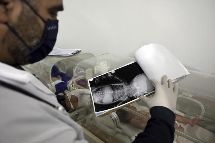 סוריה רעידת אדמה התינוקת איה שנולדה מתחת להריסות ואז אמה מתה מאושפזת בבית חולים
