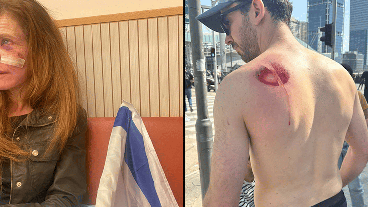 דן פלד שנפגע מרימון הלם בזמן המחאה נגד המהפכה המשפטית