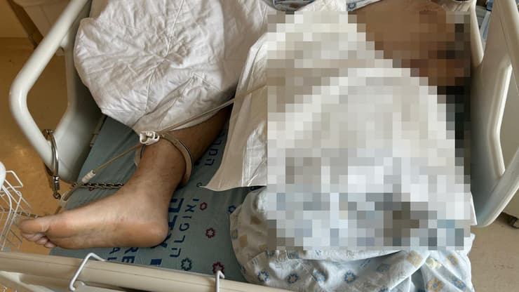 עציר פלילי אזוק למיטה בבית החולים למרות מצבו הקשה