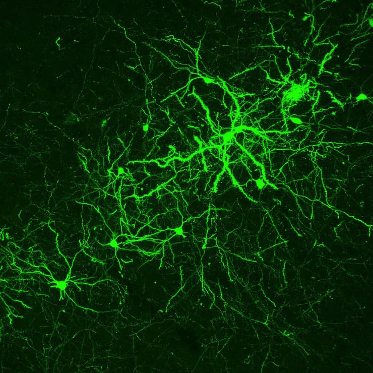 נוירונים של שליו שהודבקו בנגיף שפיתחו חוקרי הטכניון. על גבי הנוירונים אפשר לראות מבנים הקרויים spines 