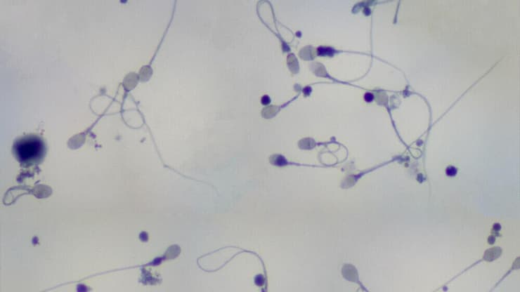 תאי זרע מתחת למיקרוסקופ