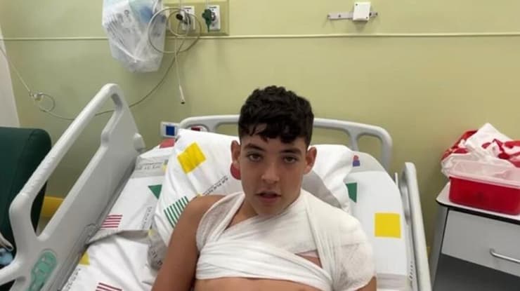זוהר בן 15 נפצע בכפר עזה