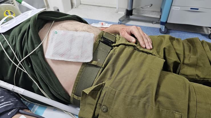 מדבקה תרמית פיתוח של סטארט-אפ ישראלי ובית החולים רמב"ם