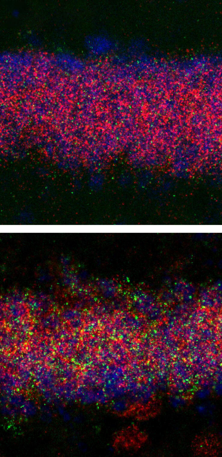 תאי עצב בהיפוקמפוס של עכברים בוגרים שנחשפו לטראומה בגיל צעיר (למטה) הגיבו באופן שונה לבריונות מאשר תאים אלה בעכברים שלא נחשפו לטראומה בגיל צעיר (למעלה)