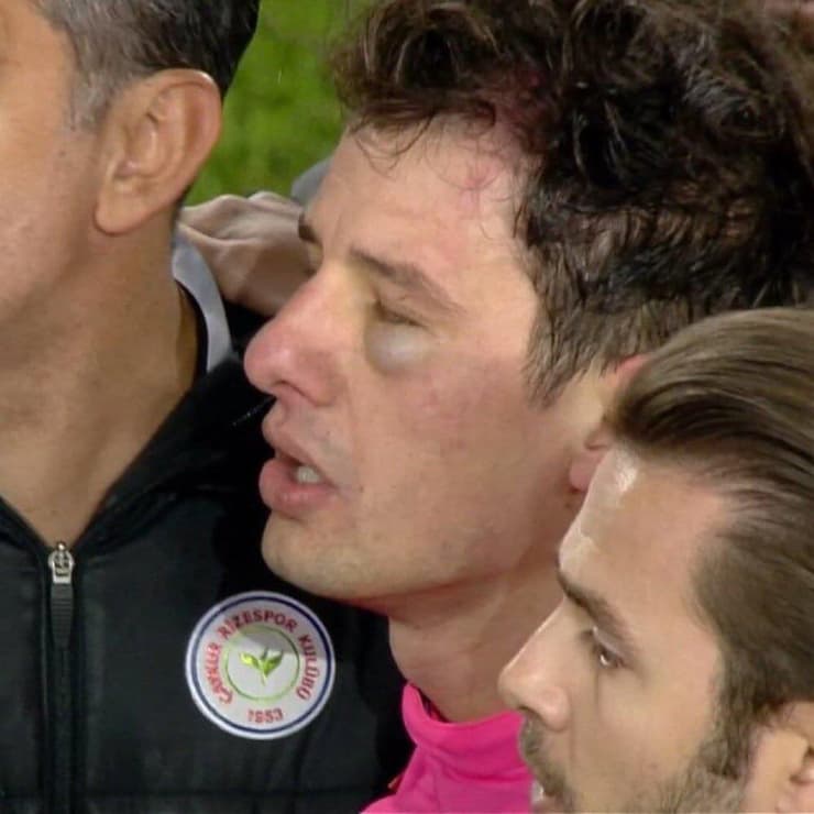 השופט שהותקף על ידי נשיא אנקרגוצ'ו