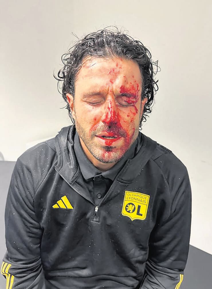 מאמן ליון פאביו גרוסו אחרי שאוטובוס הקבוצה נרגם באבנים
