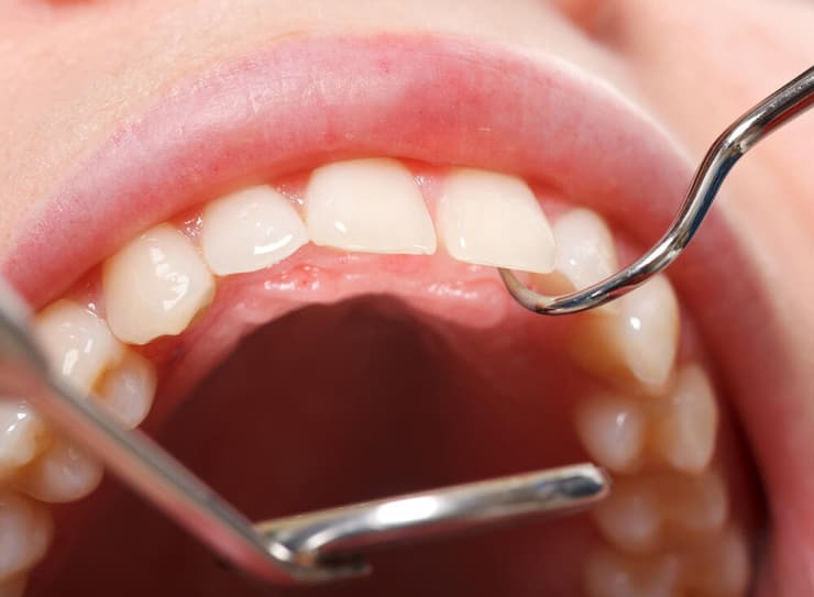 שיניים בריאות הפה