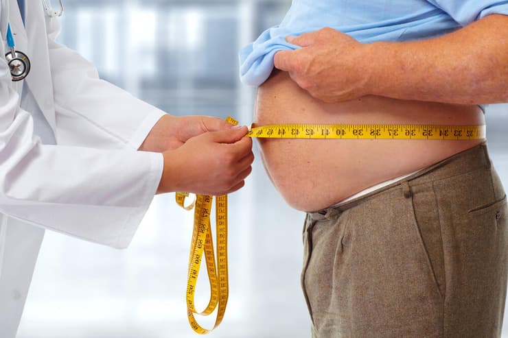 השמנה השמנת יתר עודף משקל