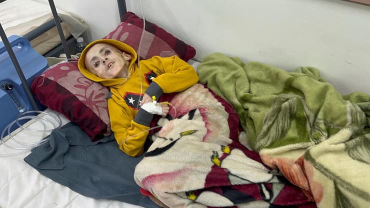 יזן אל-כפארנה ילד בן 12 שסבל משיתוק מוחין ומת לטענת הפלסטינים מ תת-תזונה רעב ב בית חולים ב רפיח רצועת עזה