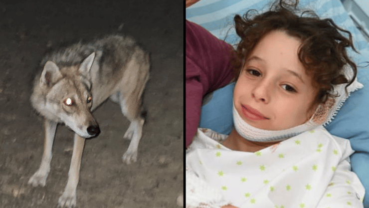 שקד בת ה 9 ננשכה על ידי זאב בגן הלאומי ממשית שבנגב