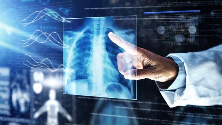 "נובוקיור לא רק ממציאה את הטיפול - אלא גם מטפלת בחולה". אילוסטרציה (צילום: shutterstock) סרטן ריאה. אילוסטרציה