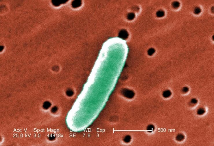 חיידק אי-קולי תחת מיקרוסקופ אלקטרונים סורק