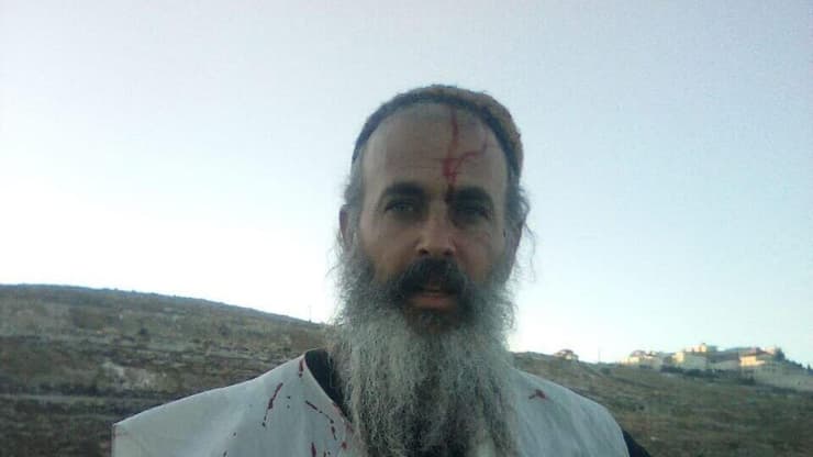 הפצוע שניצל מהפיגוע סמוך לבית ענון