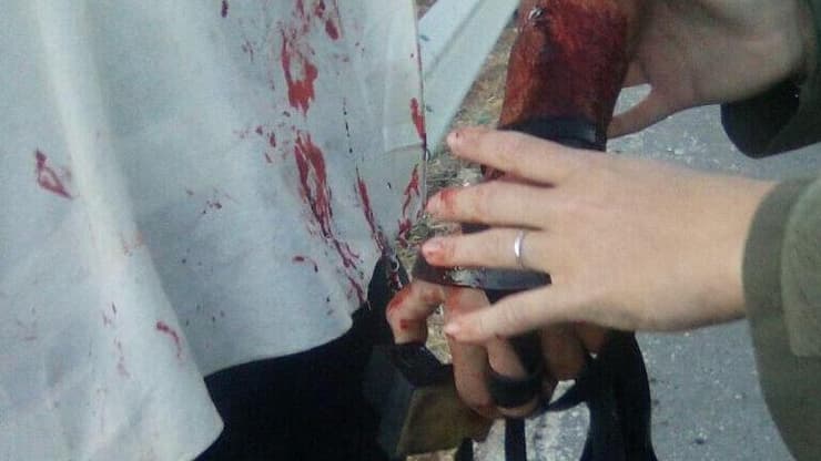 הפצוע שניצל מהפיגוע סמוך לבית ענון