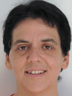 ציפי שמילוביץ 