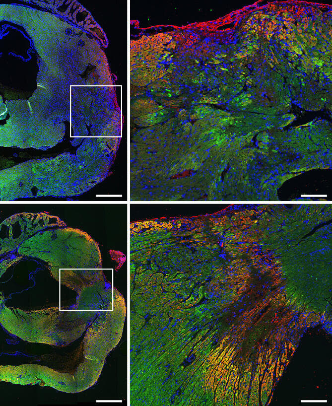 חתכים מלבבות של עכברים לאחר פציעה המדמה התקף לב. בעכברים שטופלו בקופקסון (שורה תחתונה), ניתן לראות התבטאות של חלבון המונע מוות בתאי שריר הלב (צהוב) ורקמת שריר לב שלמה יותר (ירוק) 