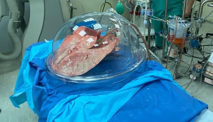 ריאה לפני השתלה.