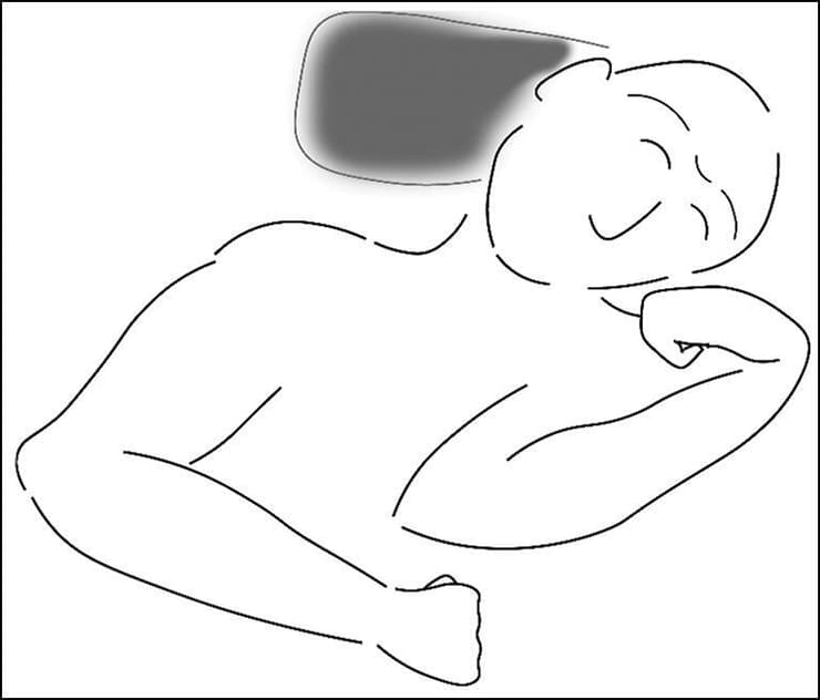 מנח הקבורה של ניאנדרטל ממערת שנידאר בעיראק. ניתן לראות את אבן הגיר המעוצבת שמונחת תחת הראש