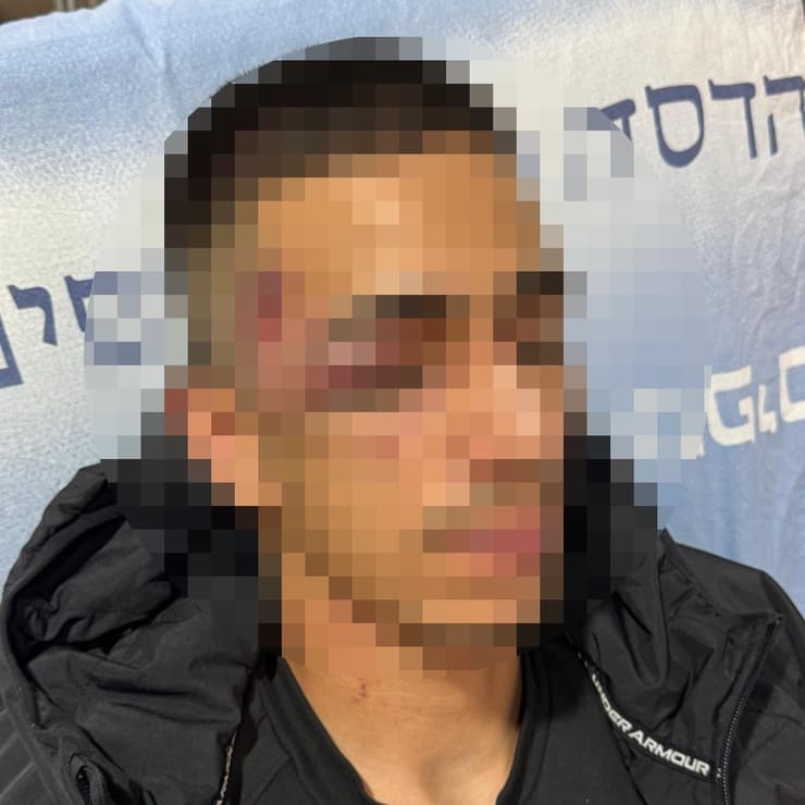 תושב מזרח ירושלים הגיש תלונה במשטרה על זה שהוכה  באכזריות בתוך מחסום  על ידי אנשי הבידוק