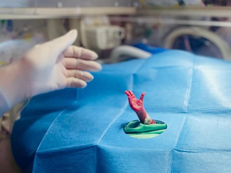 פגה נולדה בבית החולים בני ציון