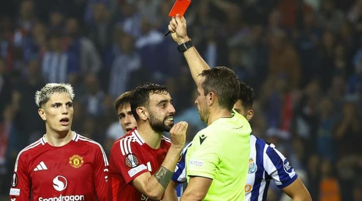 ברונו פרננדש מורחק