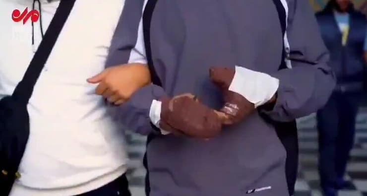 פעילי חיזבאללה שנפגעו במתקפת הביפרים מבקרים בקבר האימאם עלי רזא במשהד, איראן