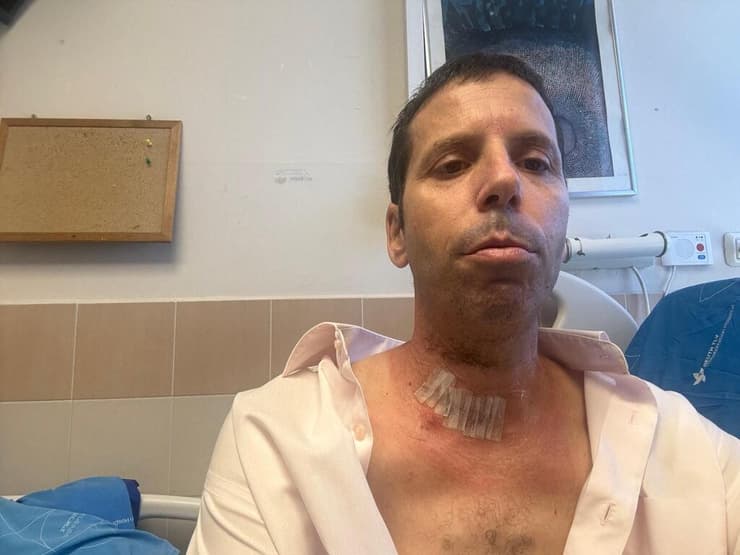אורי מיכאל לאחר הפציעה