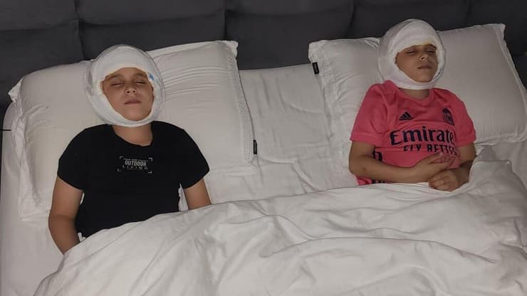 אופק ורועי ניתוח להצמדת אוזניים