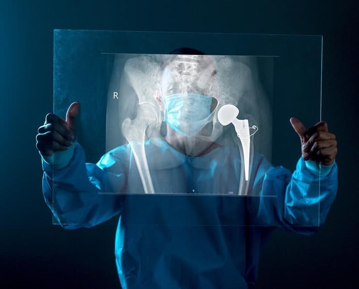 ניתוח החלפת מפרק ירך