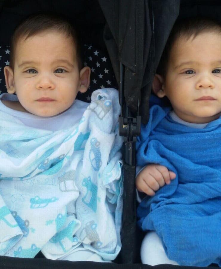 אופק ורועי ניתוח להצמדת אוזניים