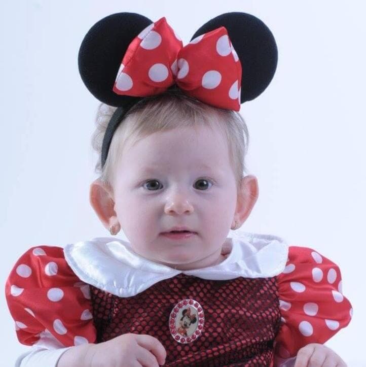 שובל דיין ניתוח להצמדת אוזניים