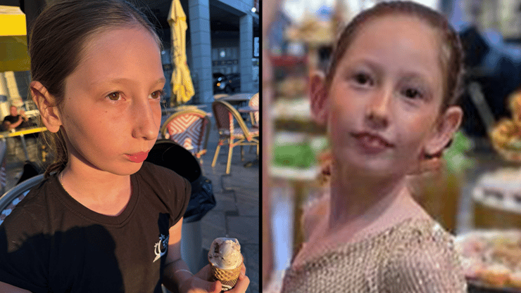 שובל דיין ניתוח הצמדת אוזניים