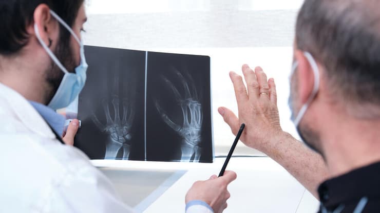 ראומטולוגיה