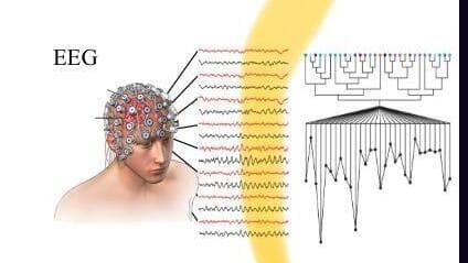 תרשים המסביר את ניתוח בדיקות ה-EEG שמובילה ד"ר רום אליעז, מנכ"ל Insight Axis