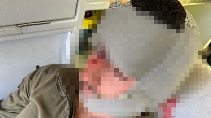 לוחם נפצע מבקבוק תבערה שהשליכו עליו מתנחלים ליד גבעת אסף