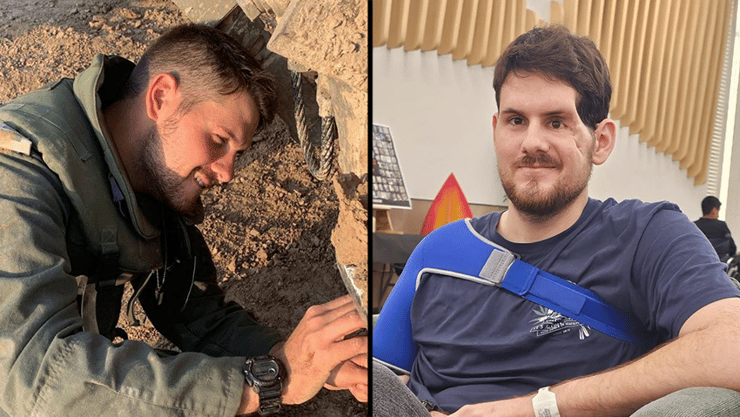 סער גנור לפני ואחרי הפציעה הקשה. הגולגולת שוחזרה בניתוח חדשני סער גנור לפני ואחרי הפציעה