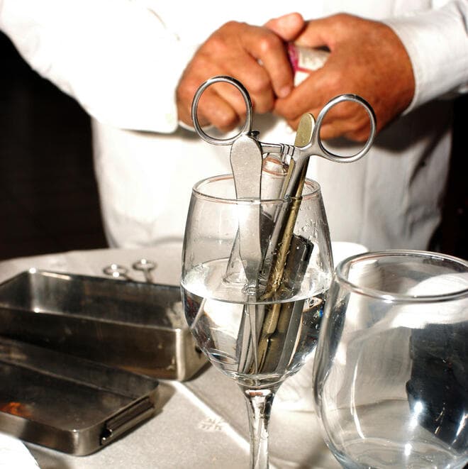 "יש צורך אמיתי ברגולציה של בריתות מילה במאה ה-21"