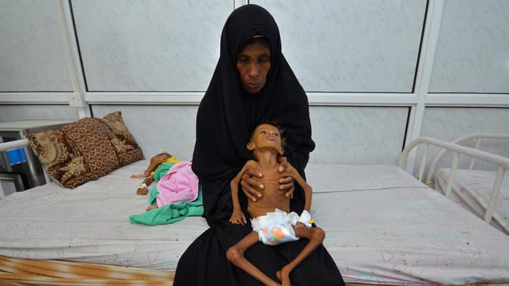 תימן, 2016. בחמאס משתמשים בתמונותיהם לקמפיין הרעב